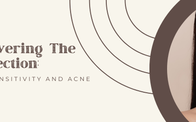 Discovering The Connection: Food Sensitivity And Acne